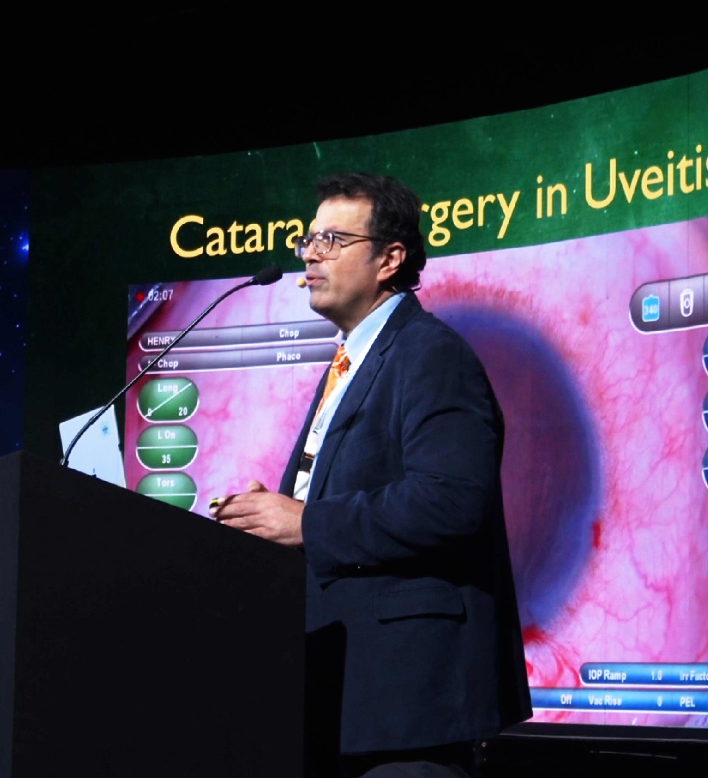 Relatore durante un congresso medico-scientifico parla da un podio con microfono, mentre alle sue spalle uno schermo mostra una presentazione su chirurgia della cataratta con immagini cliniche e dati tecnici